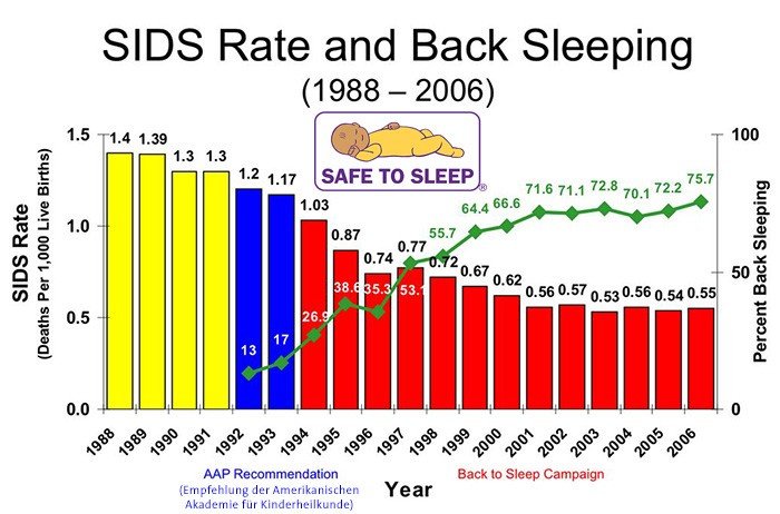 Sudden infant death syndrome